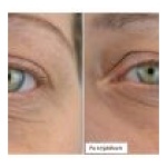 Medik8 r-Retinoate Eye Serum Day & Night