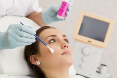 Chemický peeling