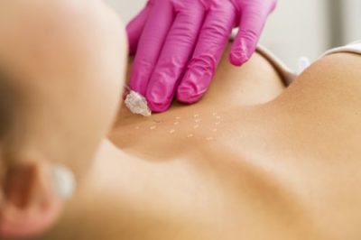 Mezoterapia